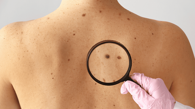 dermatology-exam-barbies-beauty-bits